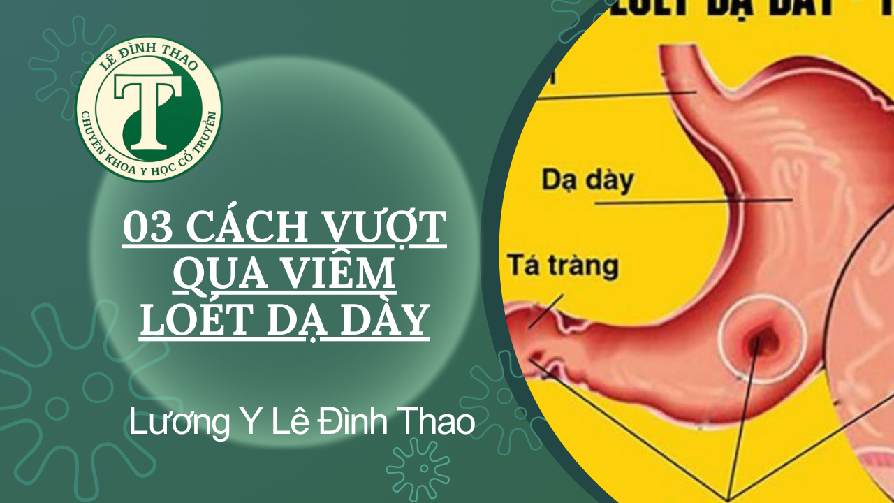 03 Cách vượt qua viêm loét dạ dày tại nhà l Lương Y Lê Đình Thao